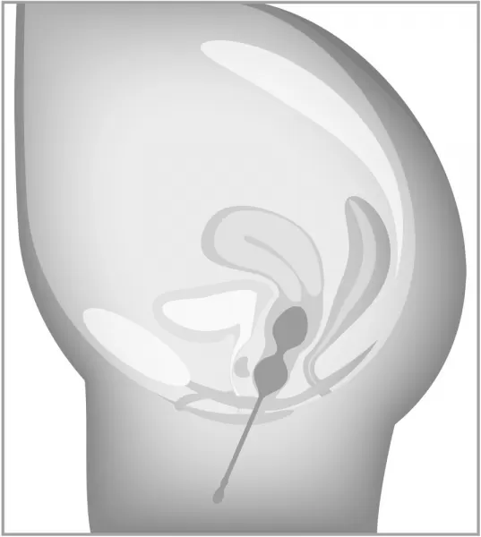 Beau coeur Elorin Love BallSet Vaginalinis kamuoliukas - rutuliukai &ndash; nuotrauka 9